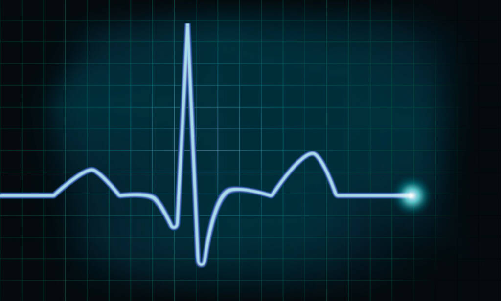 Herzschlag, Leben, Lebenszeichen, Kurve, Amplitude, http://www.shutterstock.com/de/pic-140844907/stock-vector-detailed-illustration-of-of-a-heartbeat-curve-background-eps-vector-gradient-mesh-included.html , © www.shutterstock.com (22.03.2025) 