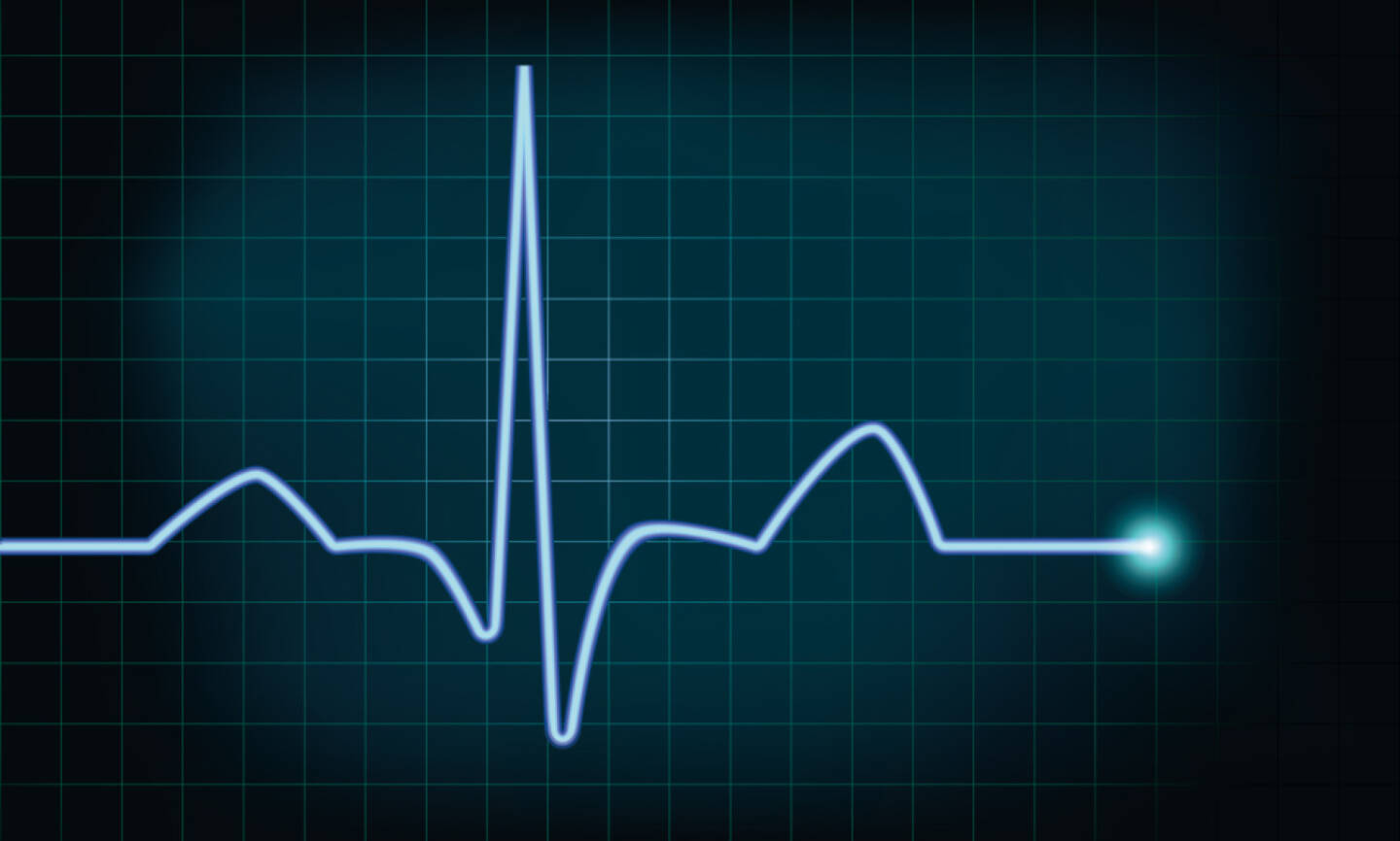 Herzschlag, Leben, Lebenszeichen, Kurve, Amplitude, http://www.shutterstock.com/de/pic-140844907/stock-vector-detailed-illustration-of-of-a-heartbeat-curve-background-eps-vector-gradient-mesh-included.html 