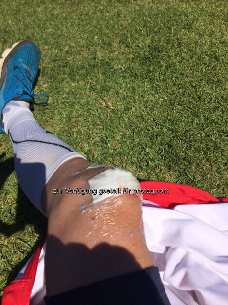 Verletzung, Sturz, Knie (15.04.2017)